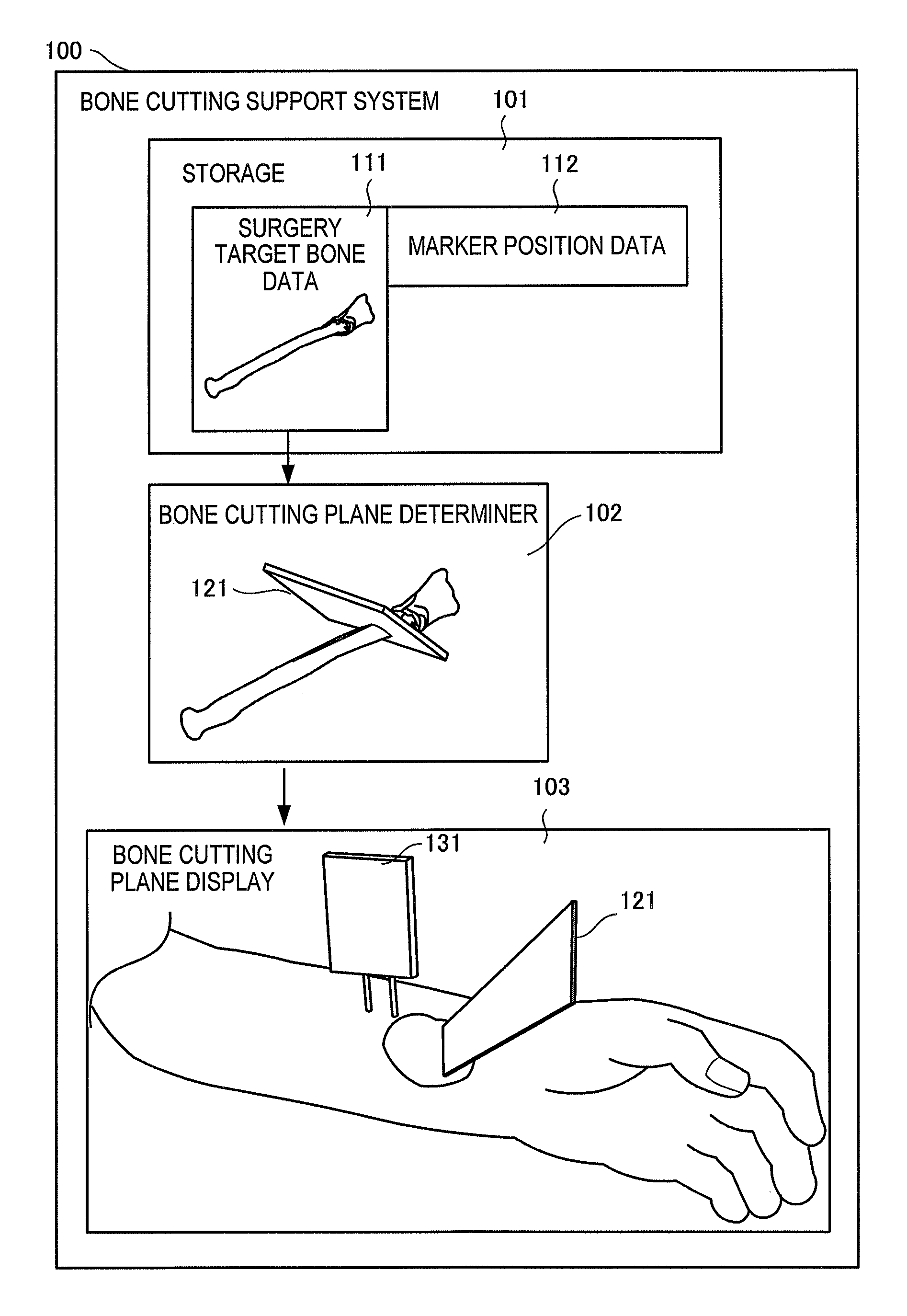 Invention for Bone Cutting Support System, Information Processing Apparatus, Image Processing Method, and Image Processing Program