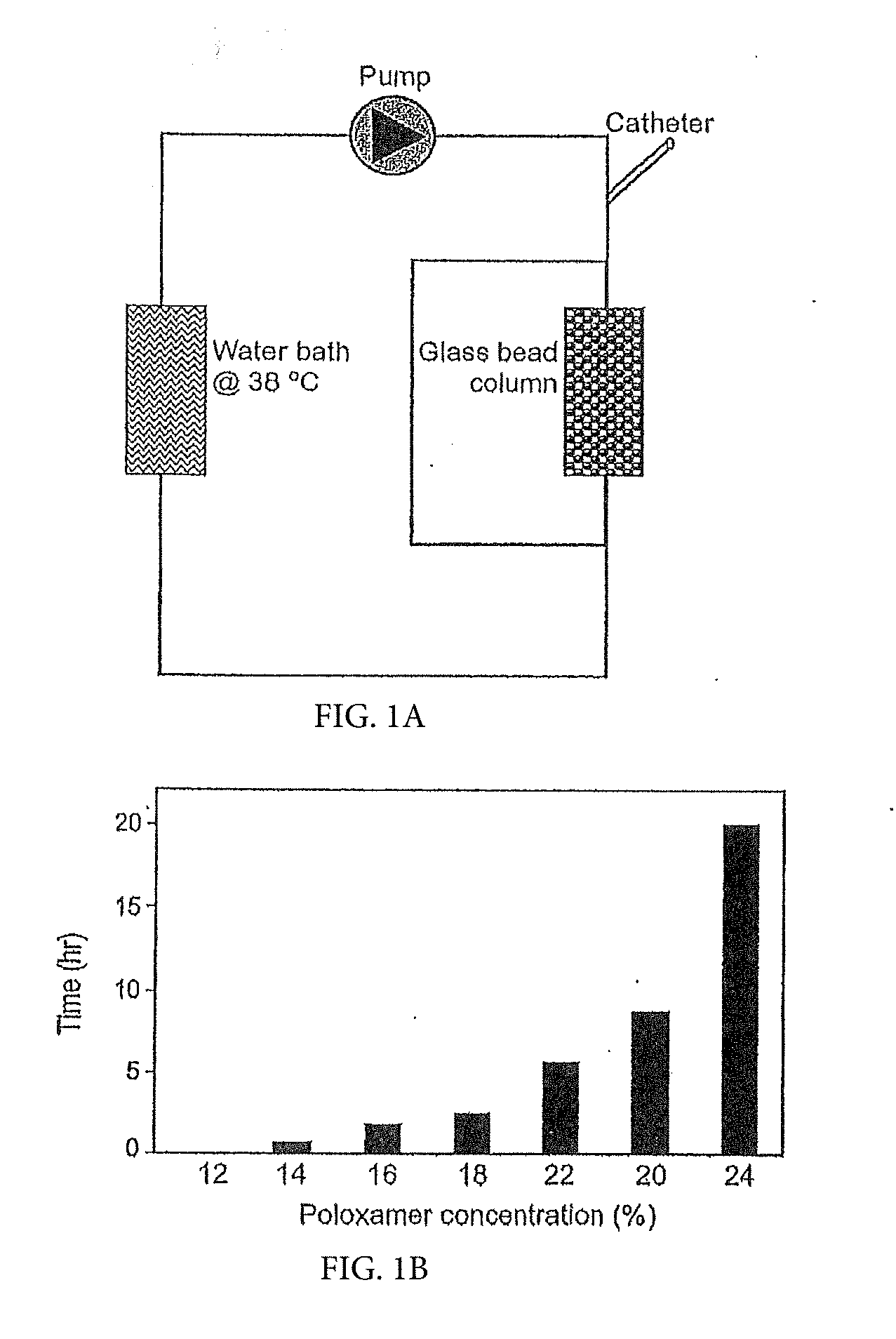 Invention for Temporary Embolization using Inverse Thermosensitive polymers