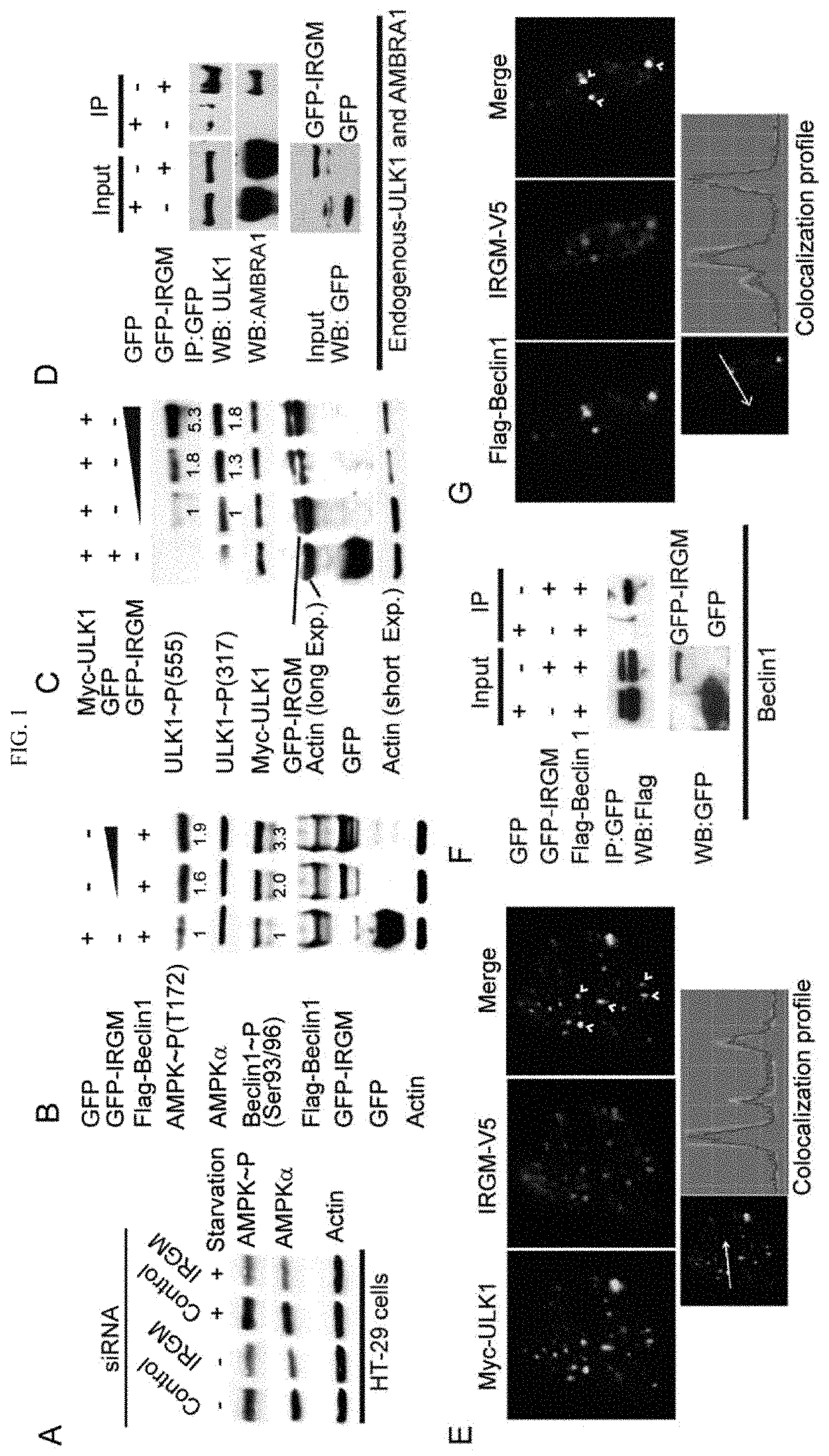 Invention for IRGM and Precision Autophagy Controls for Antimicrobial and Inflammatory Disease States and Methods of Detecting Autophagy